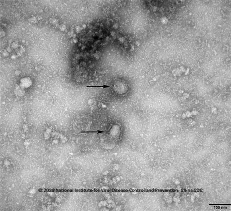 중국 우한 코로나바이러스 전자현미경 사진